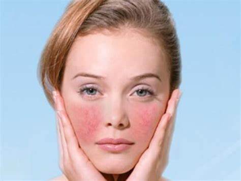 skin-allergy-2.jpg